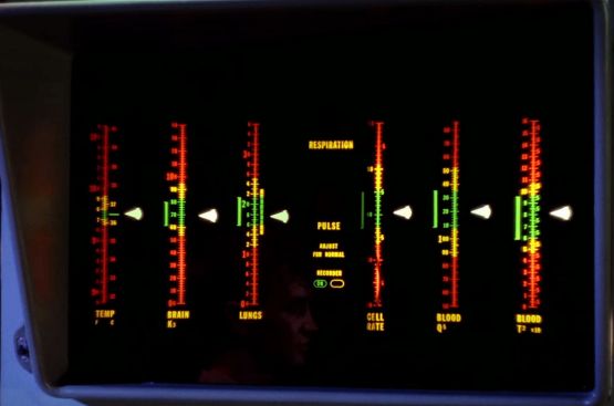 Image from Star Trek episode Charlie X showing electronic display from sickbay exam bed